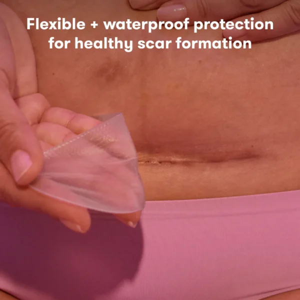 C-Section Silicone Scar Patches - Image 2